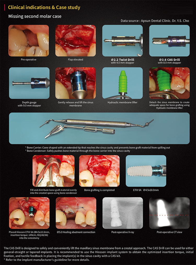 CAS-H  Hiossen Crestal Approach Sinus KIT